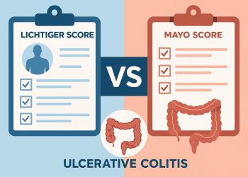 Lichtiger Score and Mayo Score comparison chart for assessing ulcerative colitis severity