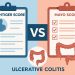 Lichtiger Score and Mayo Score comparison chart for assessing ulcerative colitis severity